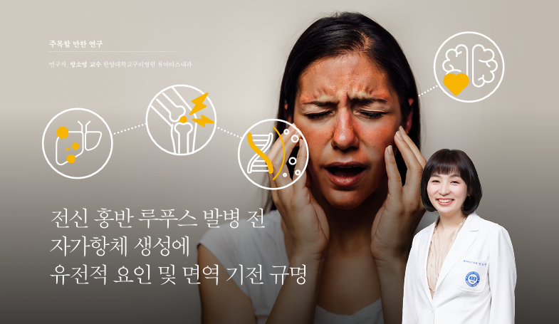 주목할 만한 연구_전신 홍반 루푸스 발병 전 자가항체 생성에 유전적 요인 및 면역 기전 규명